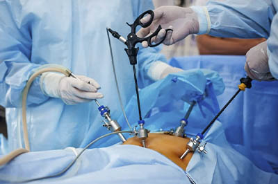 All Laparoscopic Surgery
